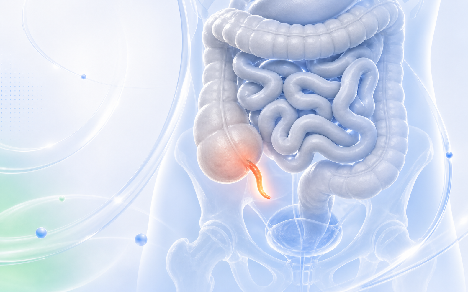Medical illustration showing an inflamed appendix